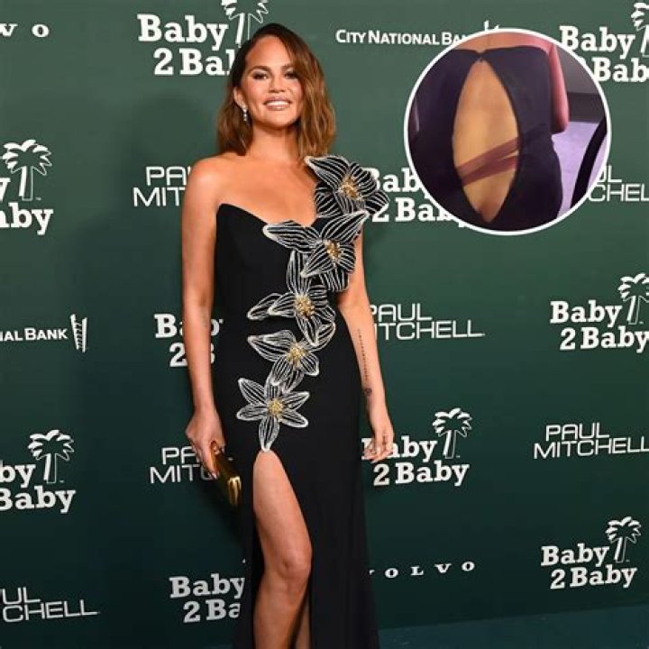 Chrissy Teigen Suffers Major Wardrobe Malfunction at Baby2Baby Gala: Photo