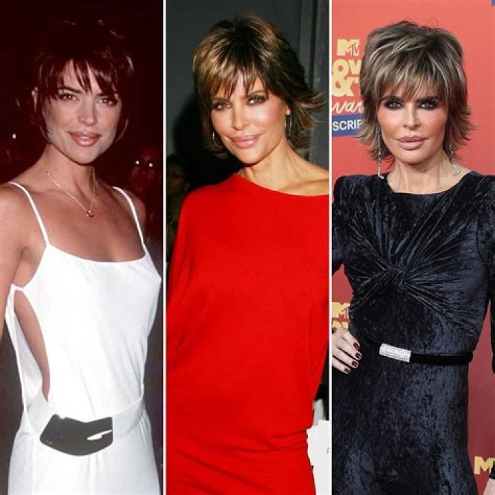 ‘RHOBH’ Alum Lisa Rinna Owns Her Plastic Surgery Journey: See Photos of Her Transformation and Quotes